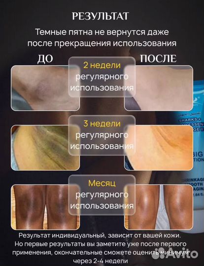 Отбеливающий крем и сыворотка