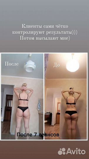 Вакуумный массаж, кавитация, RF-лифтинг