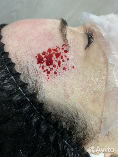 Обучение Косметологической хиджаме