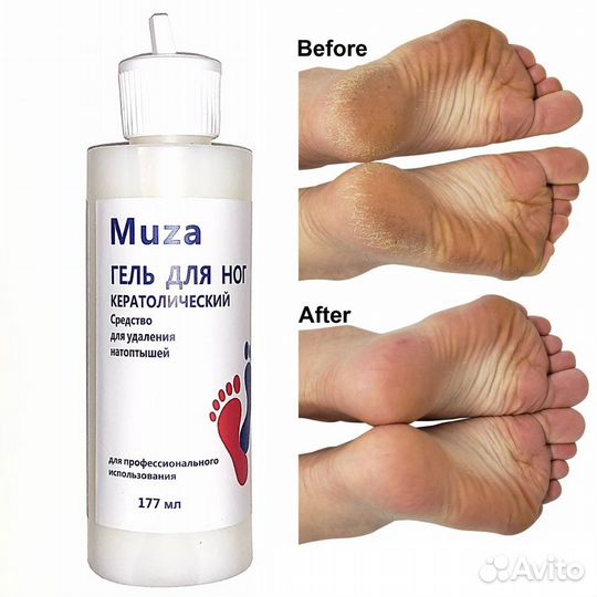 Кератолический гель для ног, 177мл