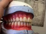 Изготовление и Ремонт зубных протезов