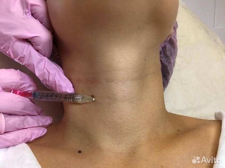 Плазмолифтинг