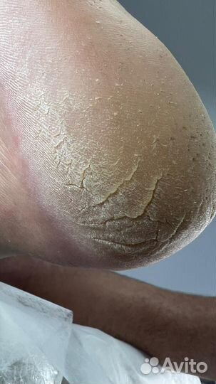 Мастер smart-педикюра и маникюра