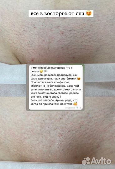 Шугаринг воск депиляция