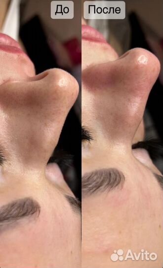 Массаж лица,расслабляющий массаж тела,чистка лица