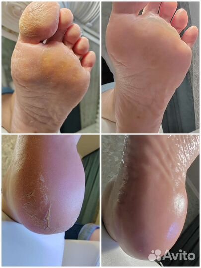 Маникюр, наращивание, гель лак, Smart педикюр