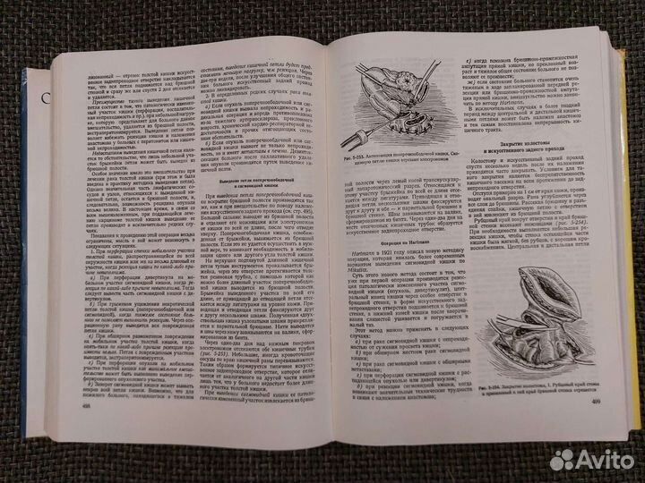 Литтманн. 2 книги. Оперативная и Брюшная хирургия