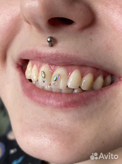 Скайсы установка