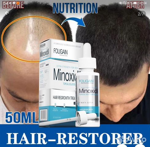 Миноксидил (Minoxidill) купить в Москве | Личные вещи | Авито