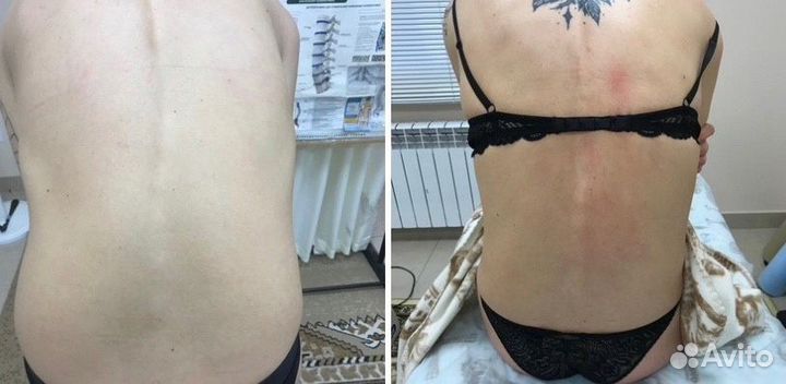 Костоправ, мануальный массаж, мед. образование