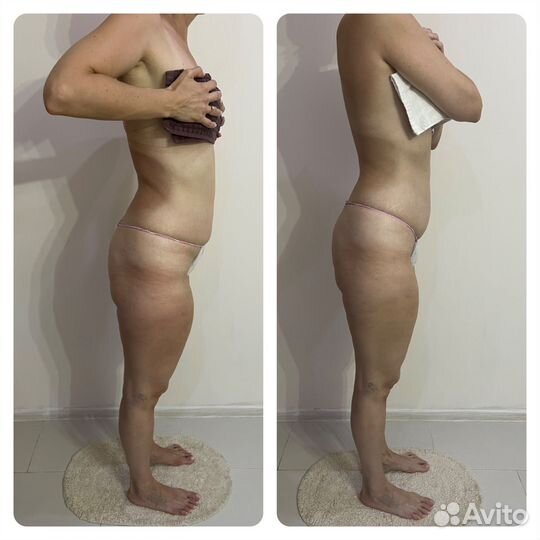 Аппаратный массаж