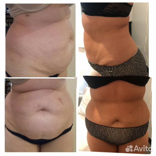 Программа стройное лицо И тело