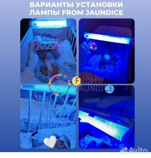 Лампа от желтушки