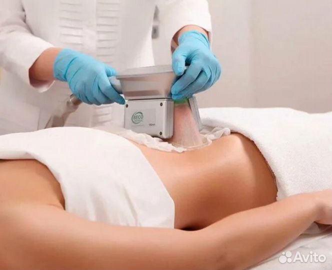 Криолиполиз