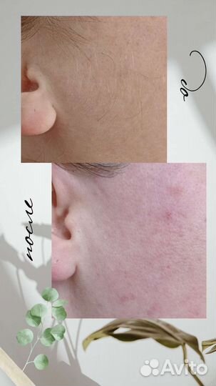 Шугаринг Депиляция Ваксинг