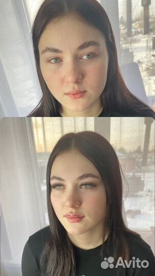 Контурная пластика губ