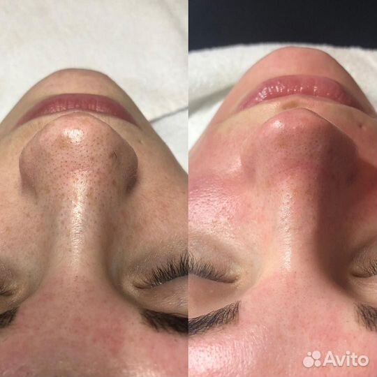 Услуги косметолога