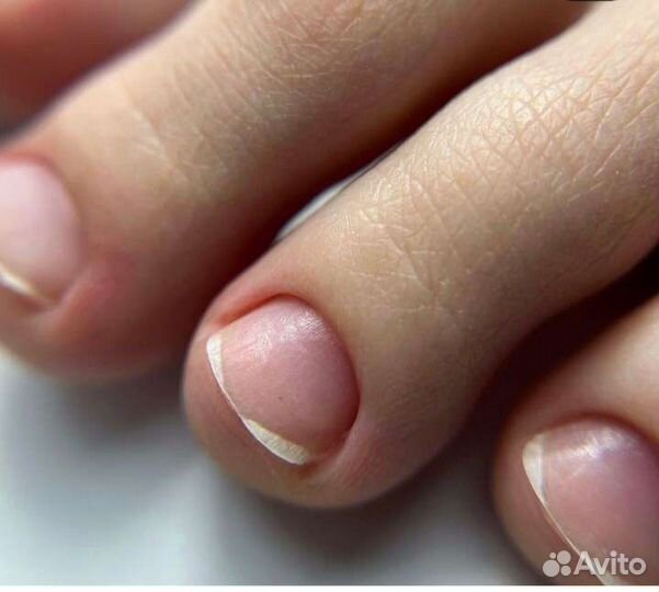 Аппаратный педикюр/эстетика, подология