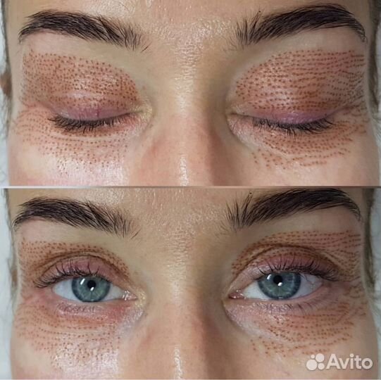 Холодная плазма/обучение