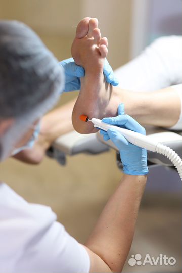 Аппаратный педикюр, подолог, вросший ноготь