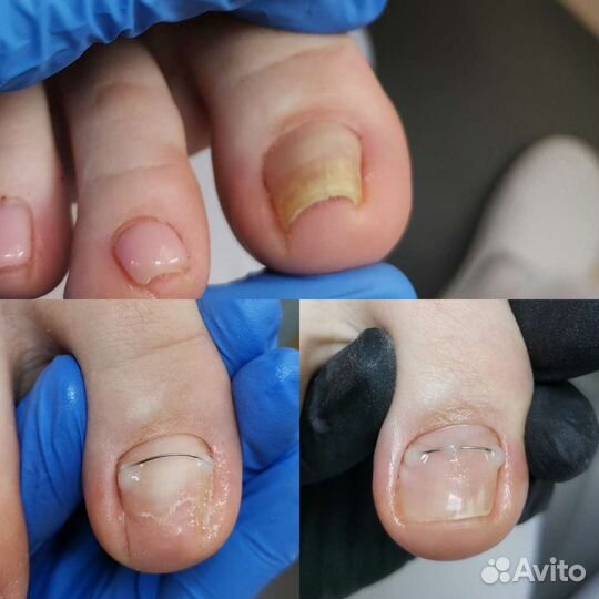 Подолог Бутово. Услуги подолога