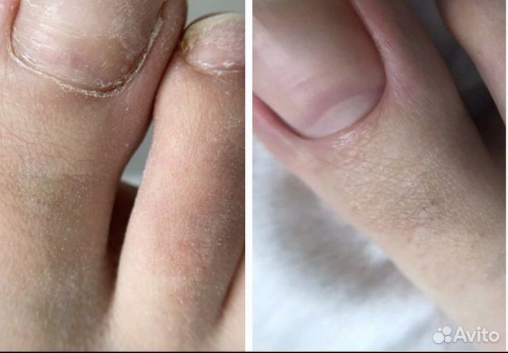 Комбинированный маникюр