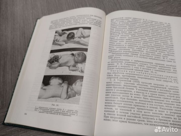 Книга по медицине. Хирургия грыж брюшной стенки