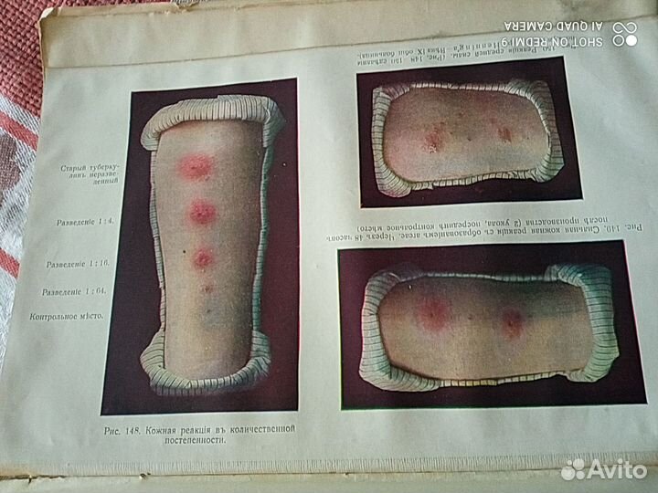 Антикварное руководство по детским болезням