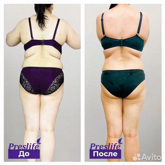 Альтернатива LPG. Программа похудения