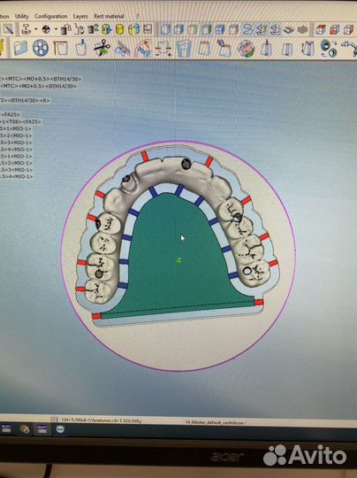Обучение exocad cad cam