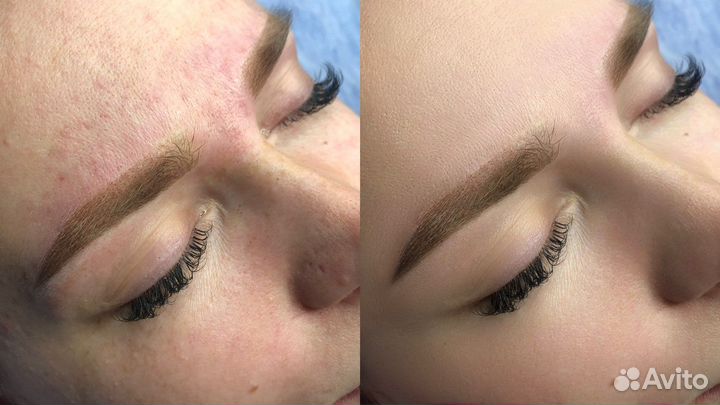 Ретушь фото. Ретушёр. Обработка фото