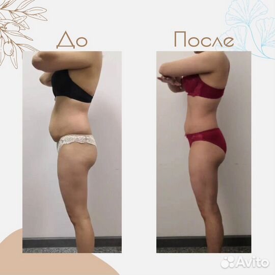 Lpg-массаж лица и тела