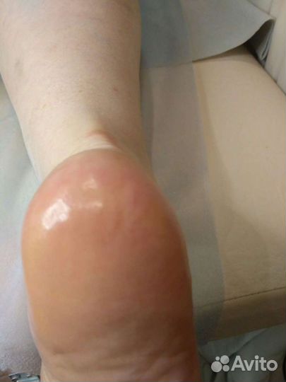 Педикюр. Медицинский педикюр. С выездом на дом