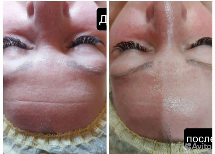 Косметик-Эстетист. Депиляция