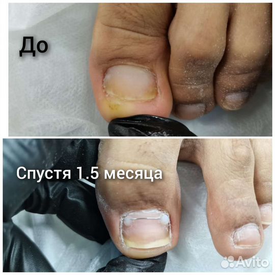 Подолог с выездом на дом