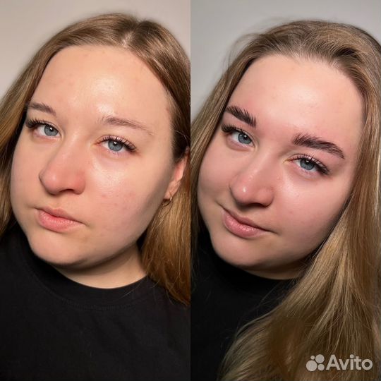 Бровист