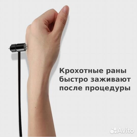 Молоточек для хиджамы