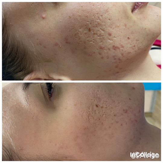 Услуги косметолога массажи инъекции чистка лица