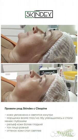 Омоложение лица