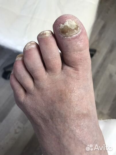 Услуги подолога