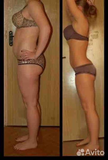 Антицеллюлитный массаж