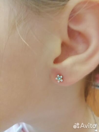 Карбокситерапия