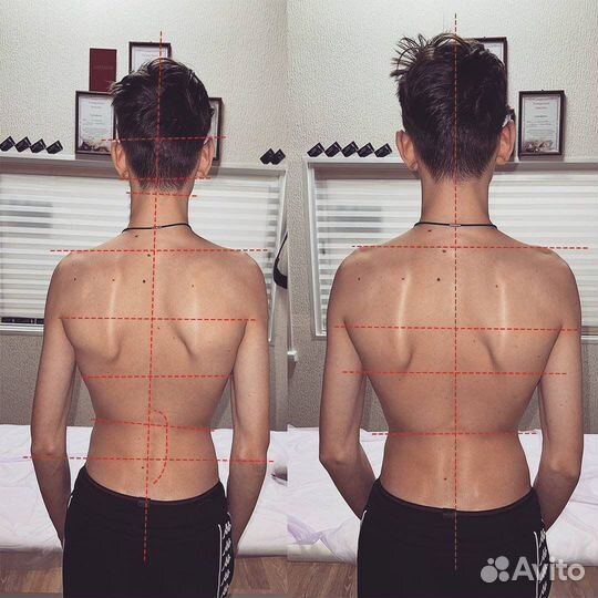 Массажист - Костоправ