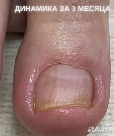 Услуги подолога