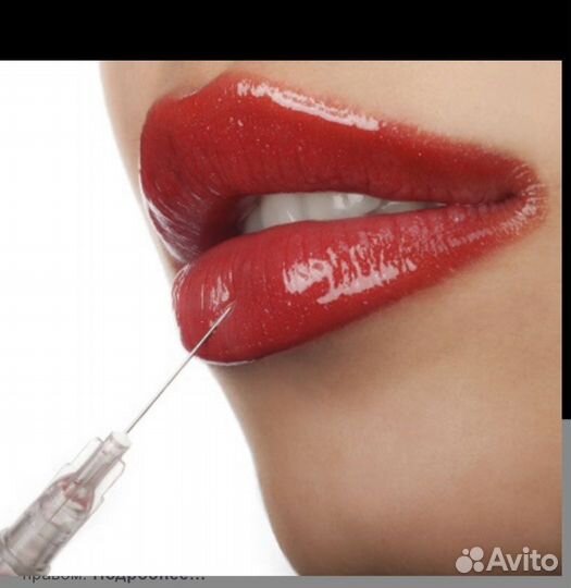 Увеличение губ