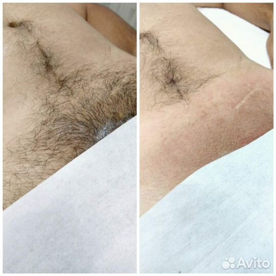 Депиляция воском: брови