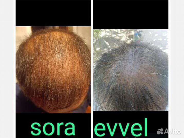 Шампунь и бальзам