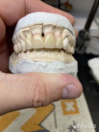 Зубной техник