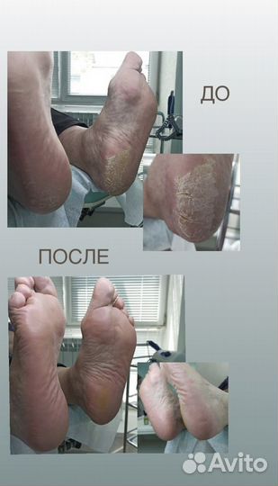 Педикюр/подолог