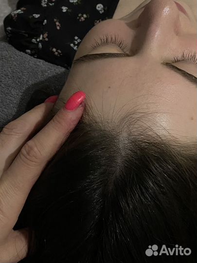 Аксесс бары и Фэйслифт